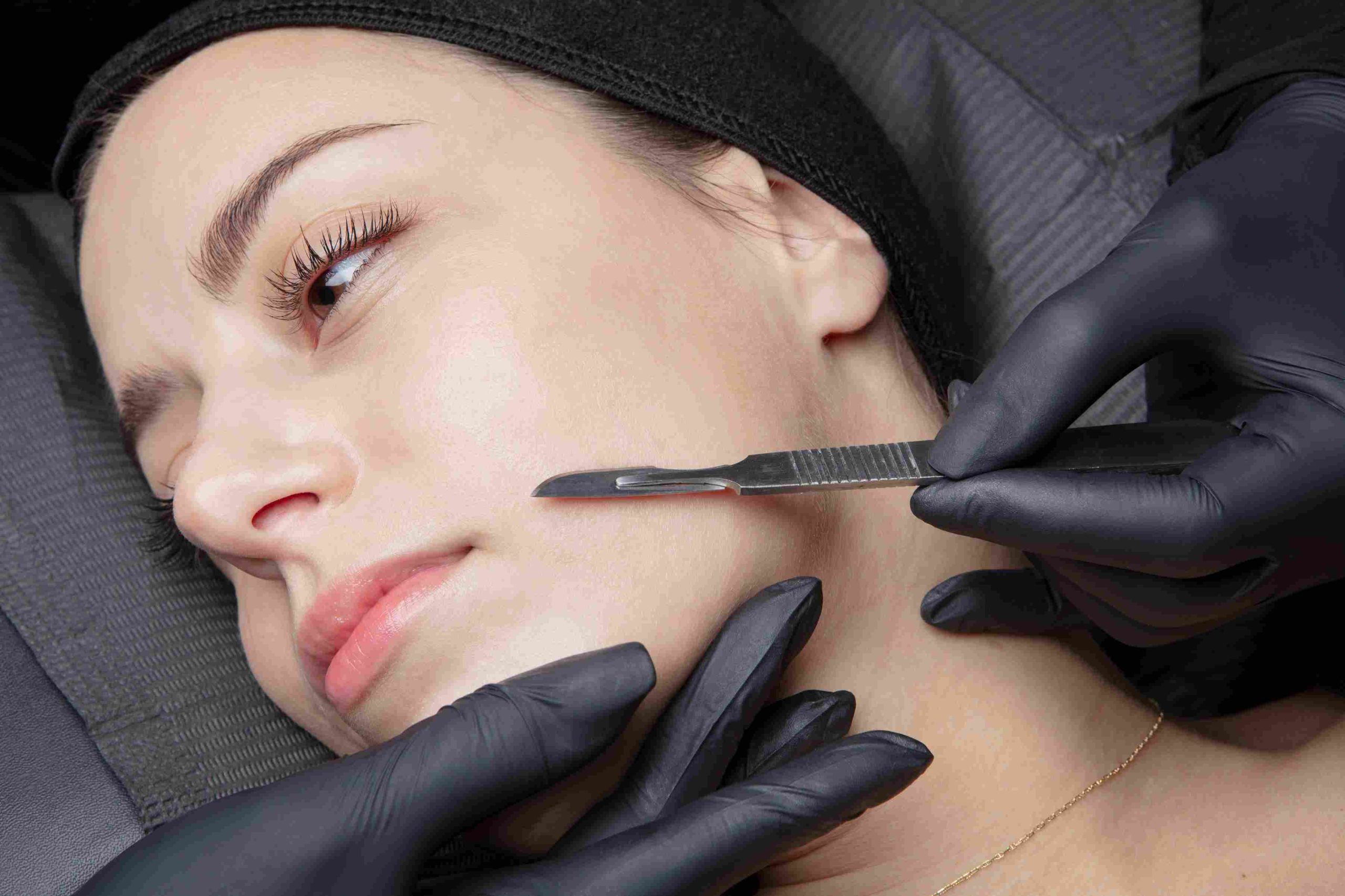 A woman getting Dermaplaning treatment | Avail Aesthetics in Cary, Raleigh & Wake Forest, NC
