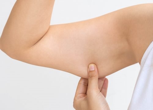 Woman pinching upper arm skin Sagging-Skin | Avail Aesthetics in Cary, Raleigh & Wake Forest, NC