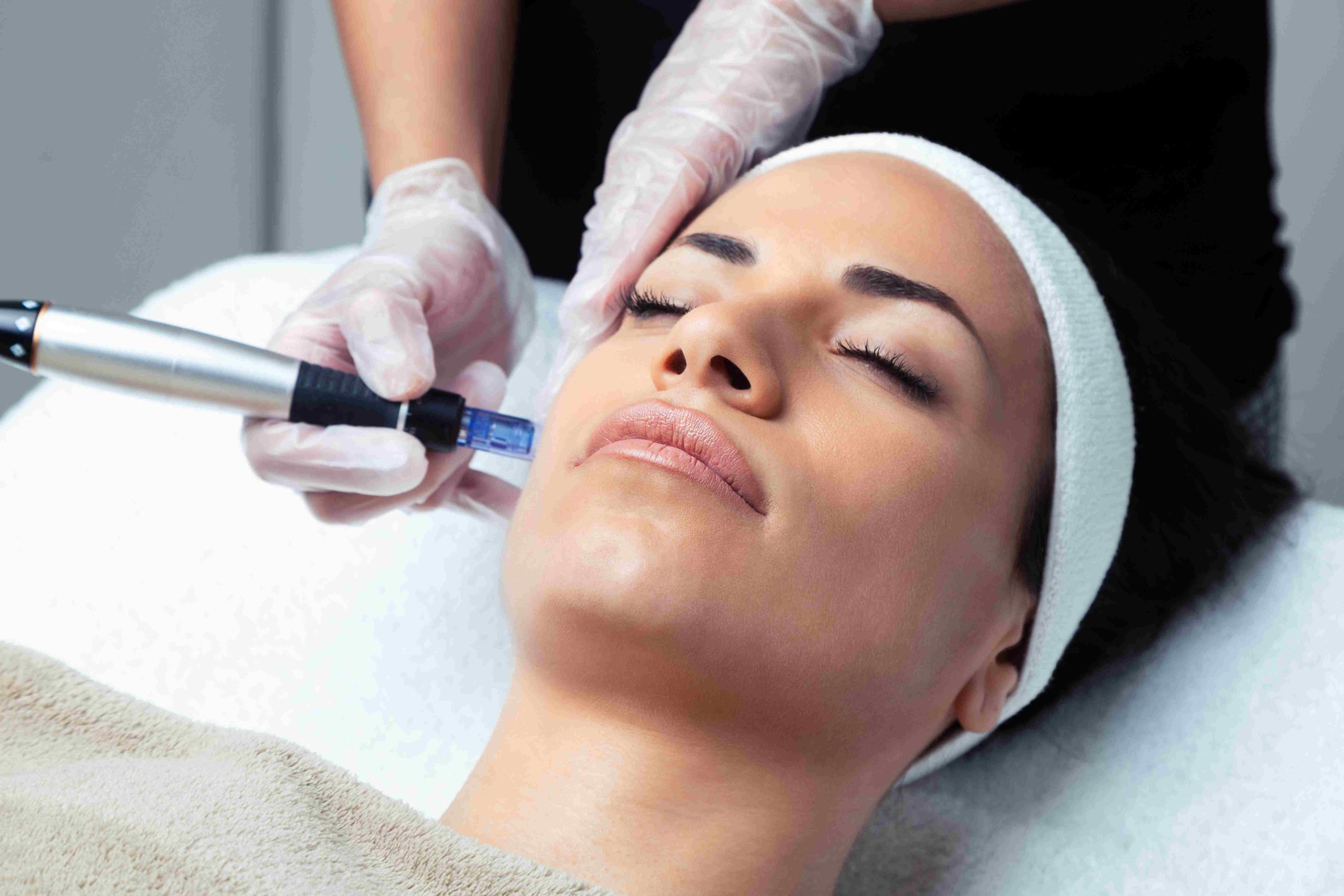 A Women getting microneedling | virtual rf microneedling | Avail Aesthetics in Cary, Raleigh & Wake Forest, NC