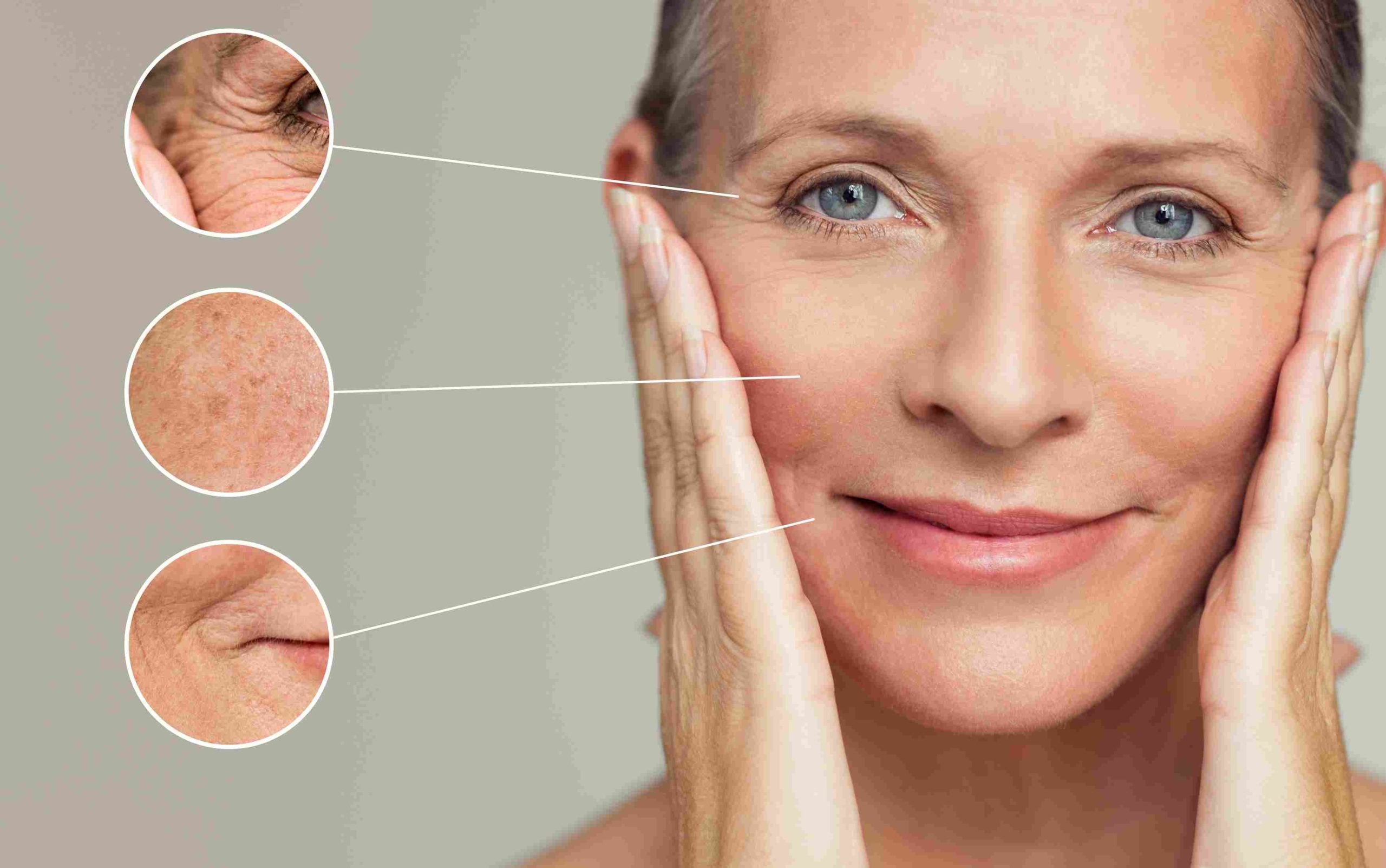 Old Woman's Skin Rejuvenation with Picosure Laser | Avail Aesthetics in Cary, NC