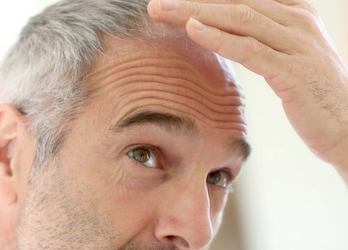 Mid-aged man checking his hair loss | Avail Aesthetics in Cary, NC