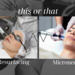 Laser Resurfacing vs Microneedling