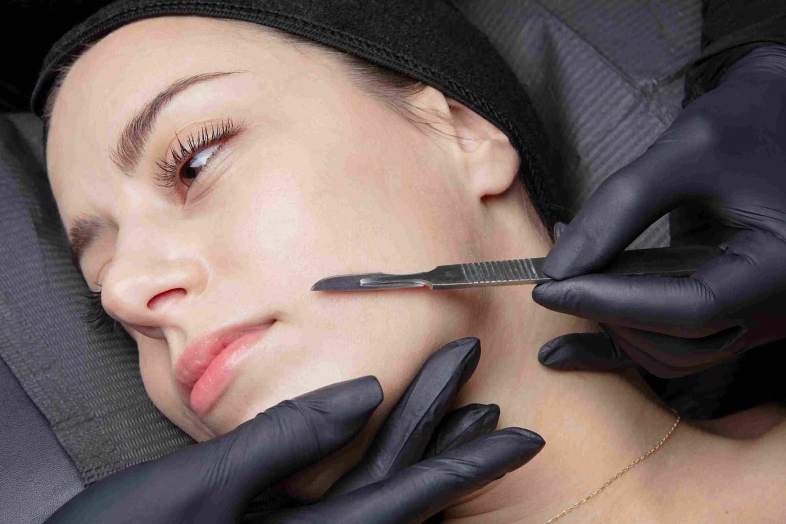 Dermaplaning-avail-aesthetics-1536x1024