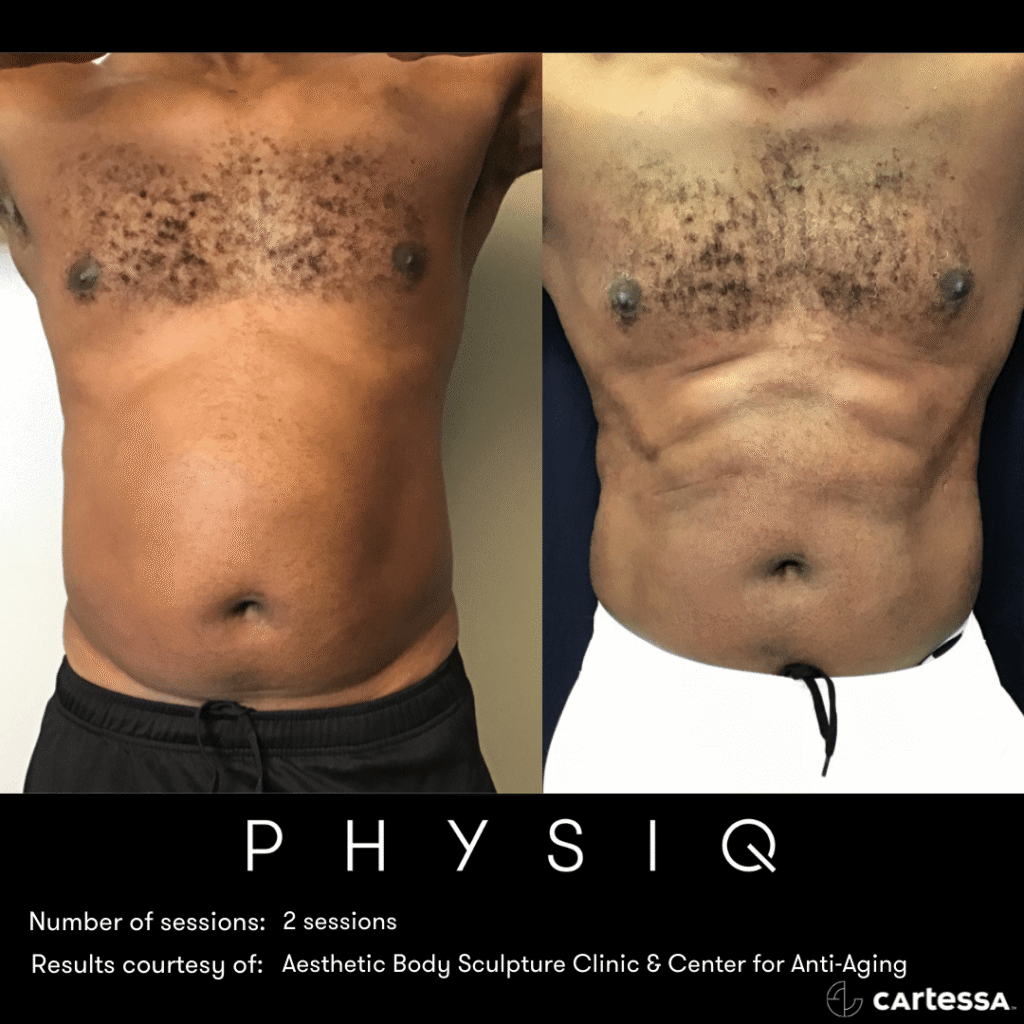 PHYSIQBAA-a