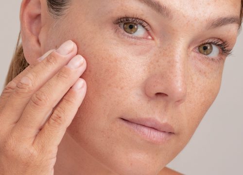 Pigments-Brown-Spots